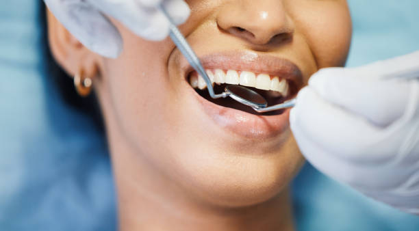 Best Weekend Emergency Dental Services in Willows, CA