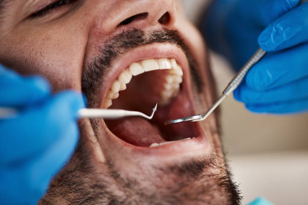 Best Emergency Dental Care for Sports Injuries in Willows, CA